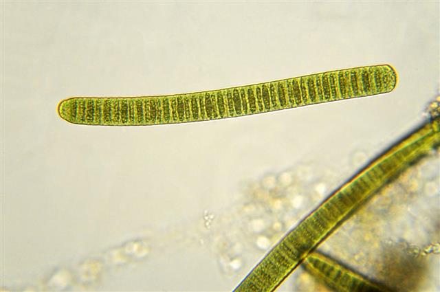 filamentous cyanobacteria