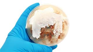 Streptomyces bacteria on agar plate