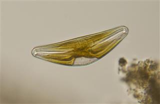 Cymbella diatom micro graph
