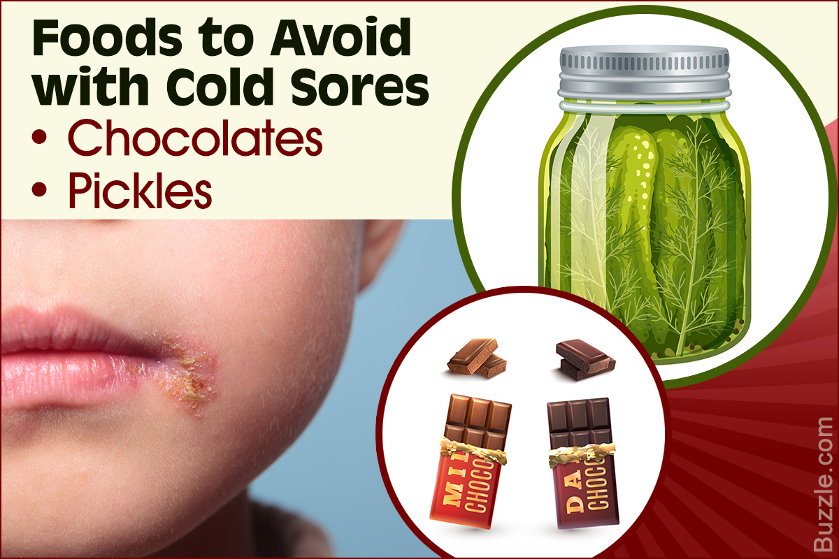 Foods to Avoid with Cold Sores