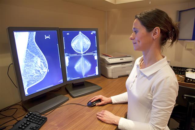 Radiology technician reviewing mammography results
