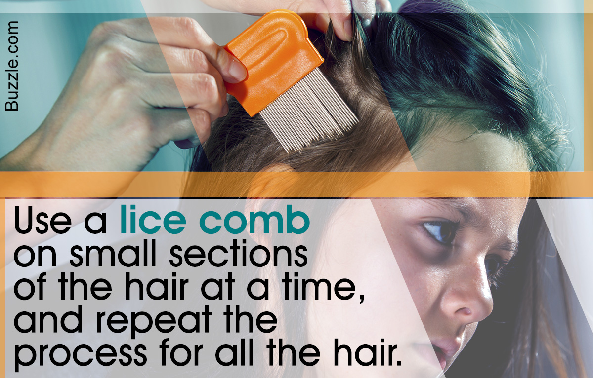 How to Check for Head Lice in Children