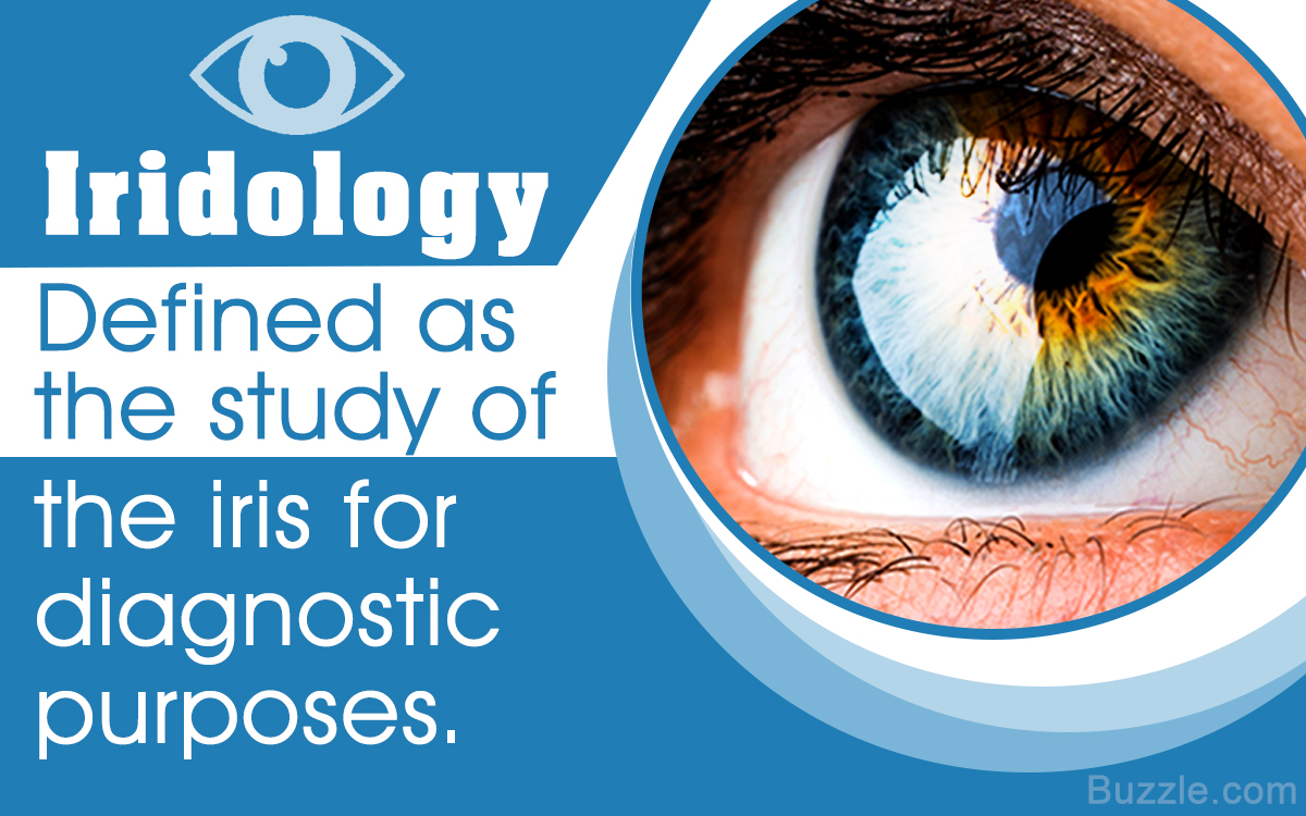 What is Iridology and Does it Really Work?