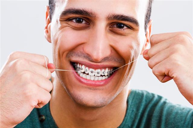 Flossing teeth and braces