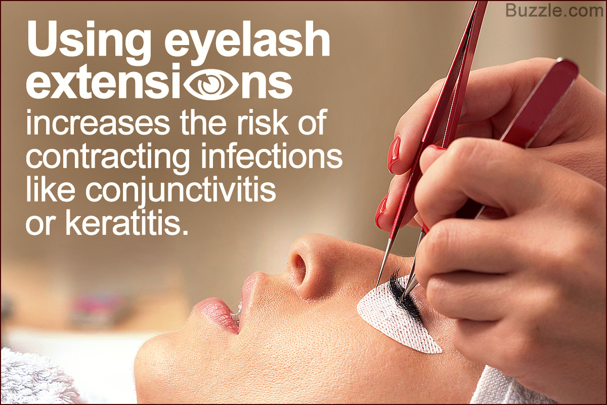 Risks of Using Eyelash Extensions