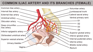 Common Internal Iliac Artery in female