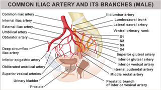 Common Internal Iliac Artery in male
