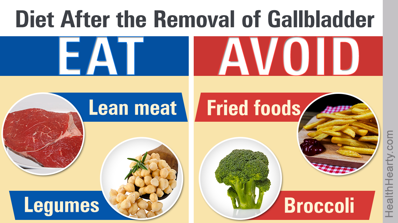 Diet after Gallbladder Removal