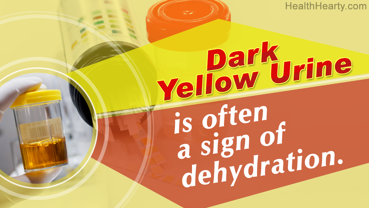 Dark Yellow Urine Causes
