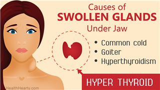 swollen lymph nodes under jaw