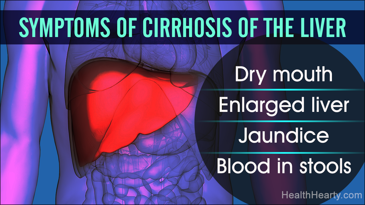 Cirrhosis Of The Liver - Life Expectancy