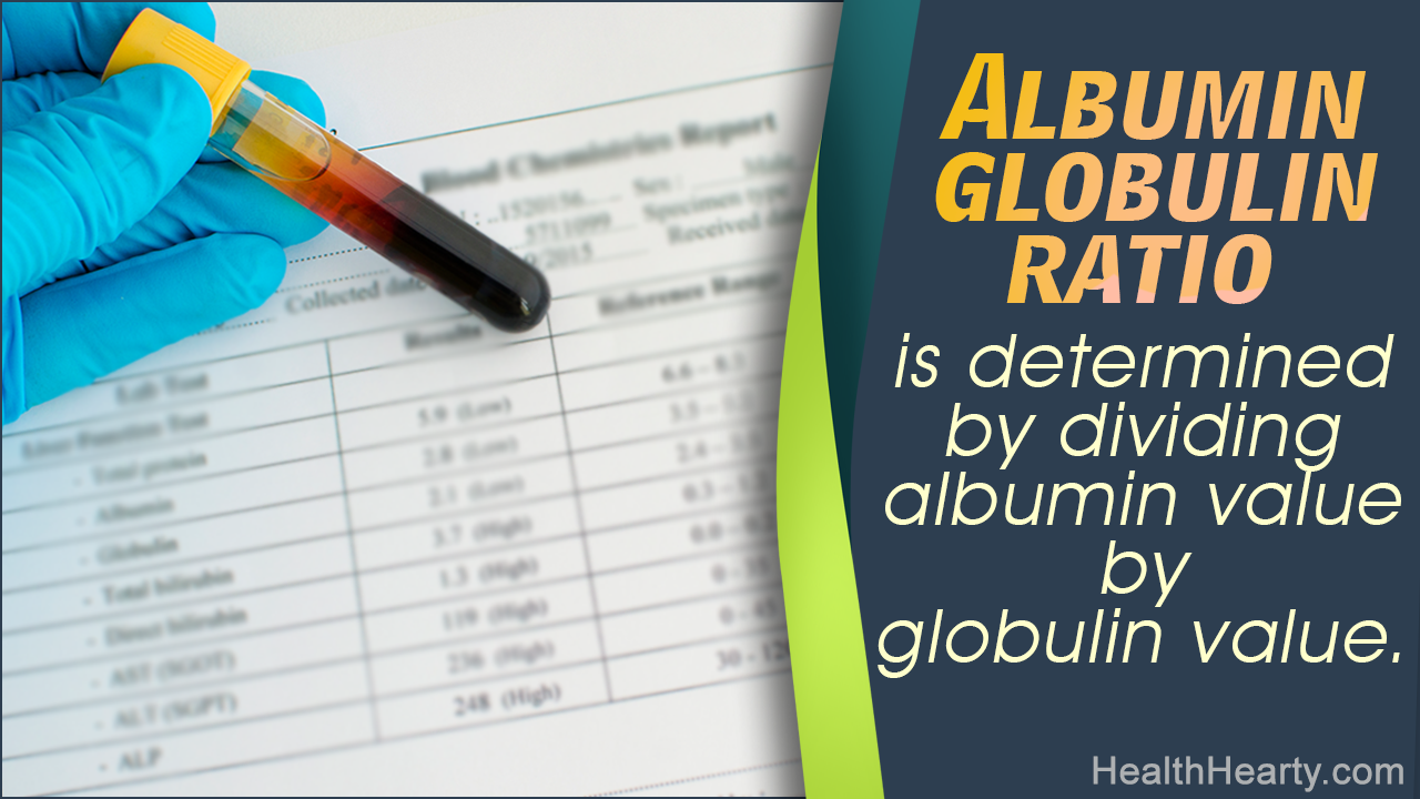 Albumin Globulin Ratio