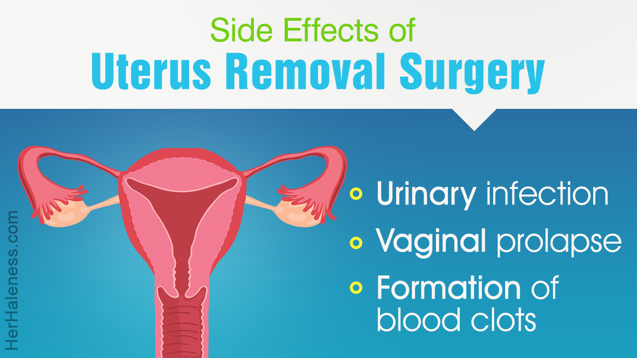 Uterus Removal Side Effects