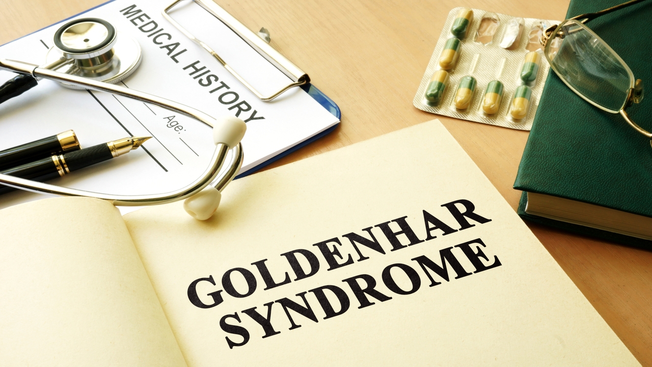 Goldenhar Syndrome - Causes, Symptoms and Treatments