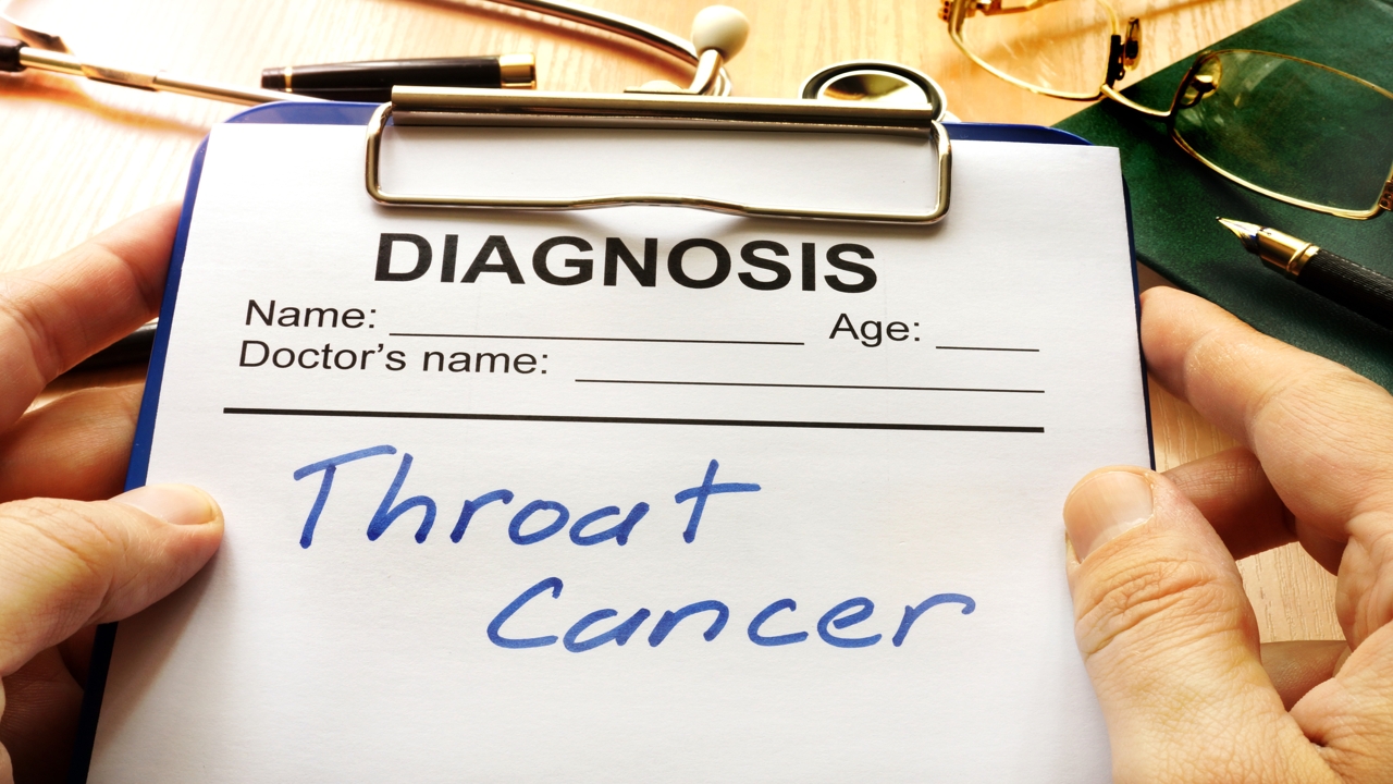 Throat Cancer Survival Rate