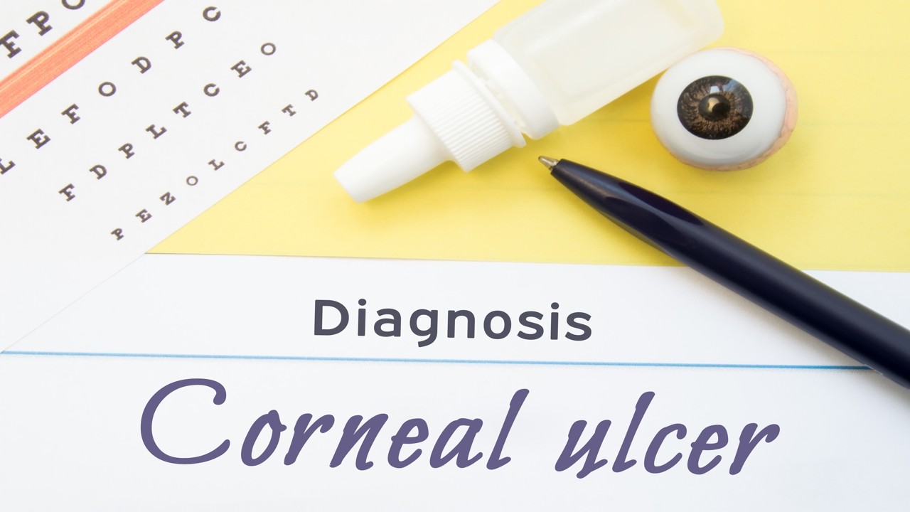 Corneal Ulcer