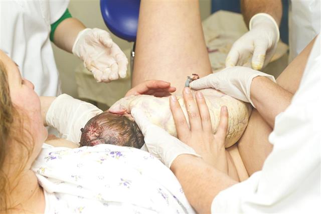 Childbirth in hospital