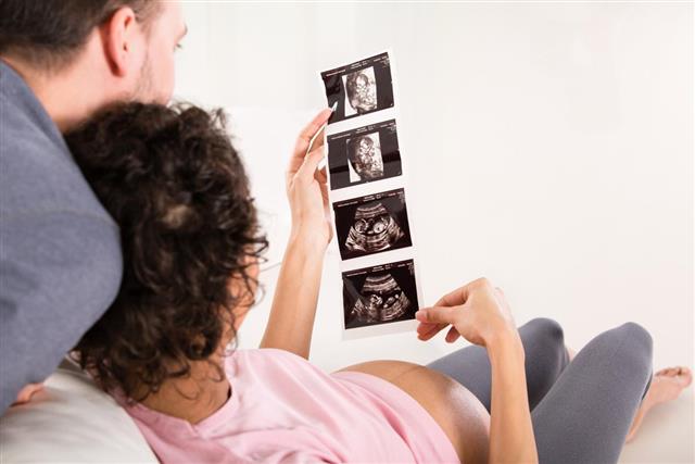 Pregnant couple looking at baby sonogram