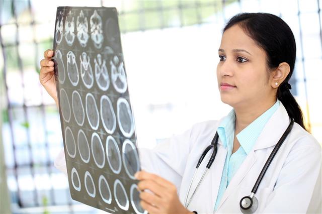 Doctor Examining Brain Tomography Scan