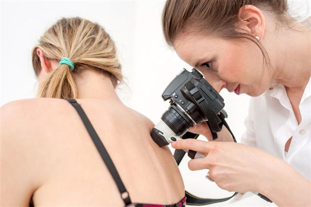 Dermatologist Inspecting Patient Skin Moles
