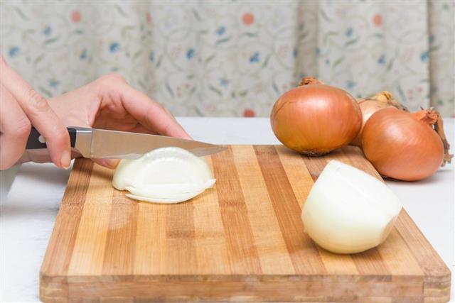 Woman's hand with a knife cuts the onion. Healthy eating
