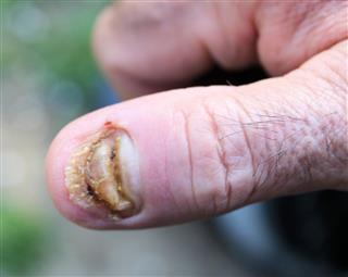 Closeup of Finger