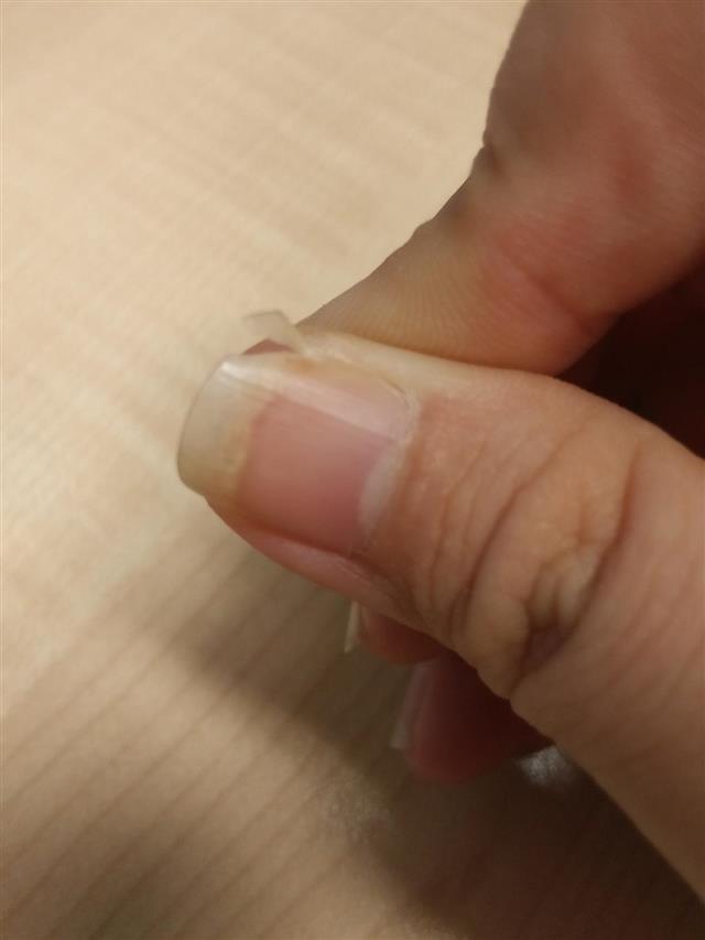 Chipped nail