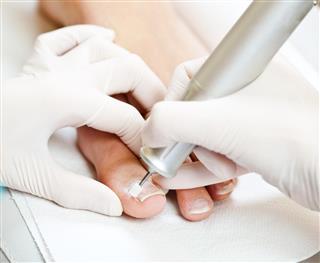 Chiropodist taking care of woman foot polishing nails with tool