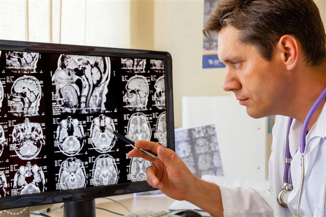 Doctor Examining Mri Scan Of Brain