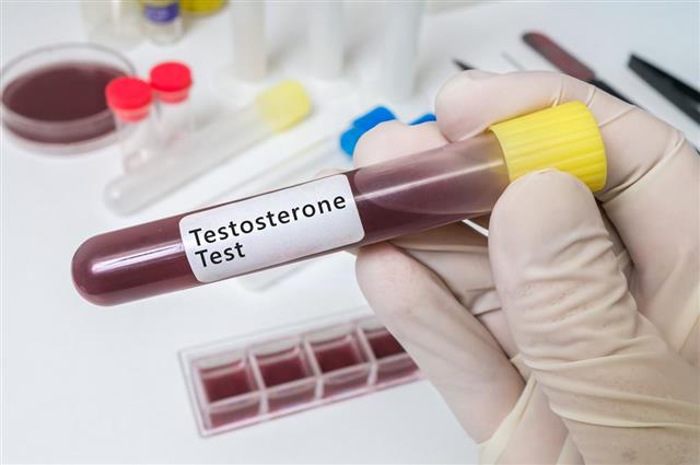 Hand holds test tube for testosterone test