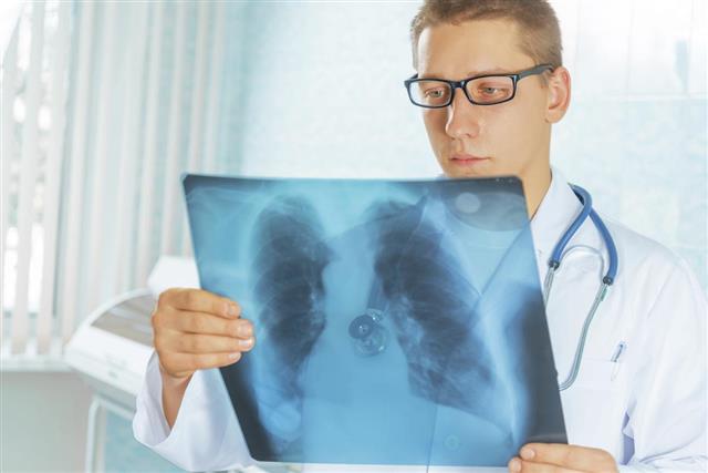 Physician looks at x-ray picture