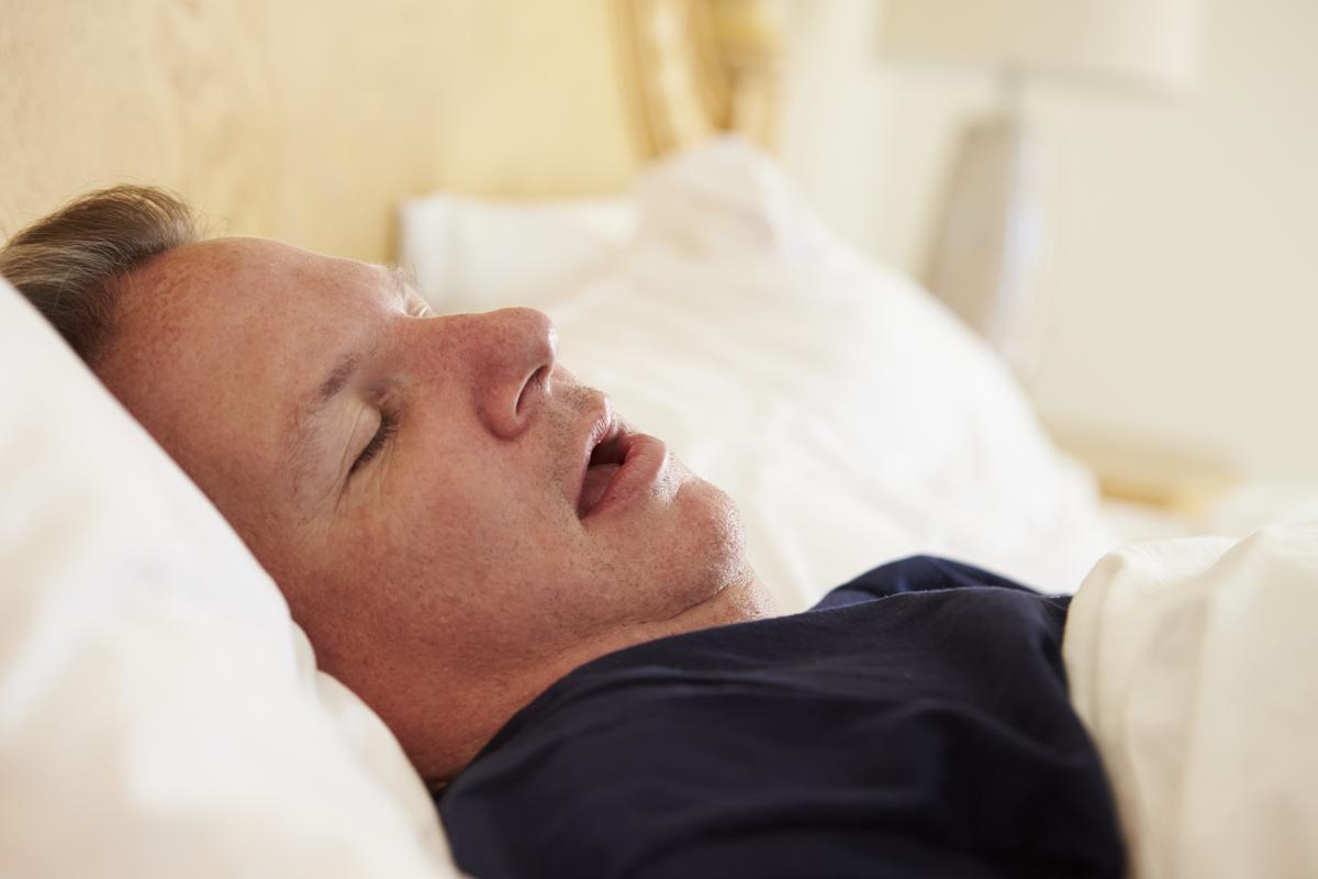 Snoring Surgery Cost