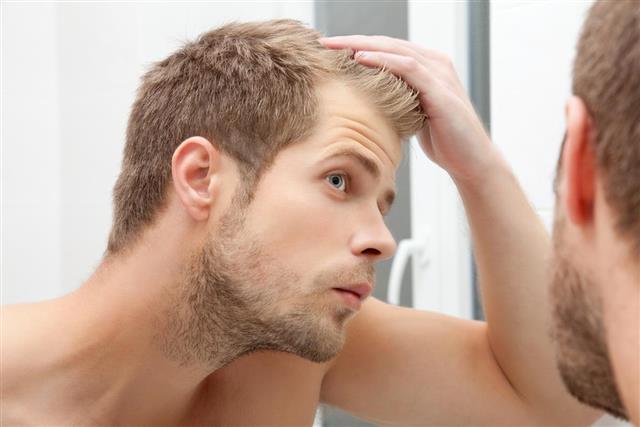 Handsome young man worried about hairloss