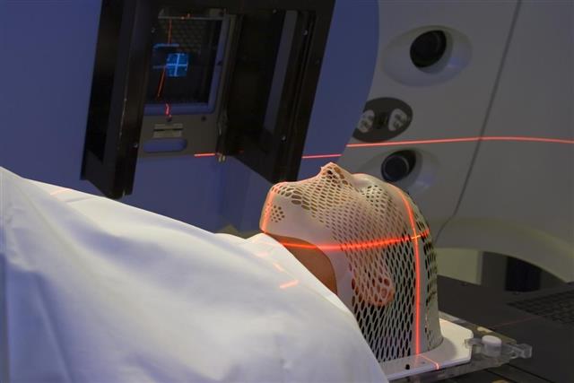 Man Receiving Radiation Treatments for Brain Cancer