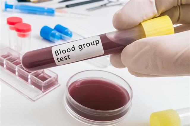 Scientist holds test tube with blood for Bloof group test