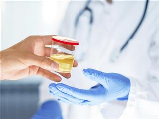 Man handing container with urine sample to a doctor