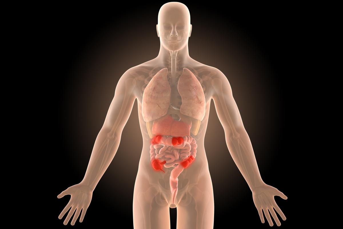 Causes of Overactive Bladder