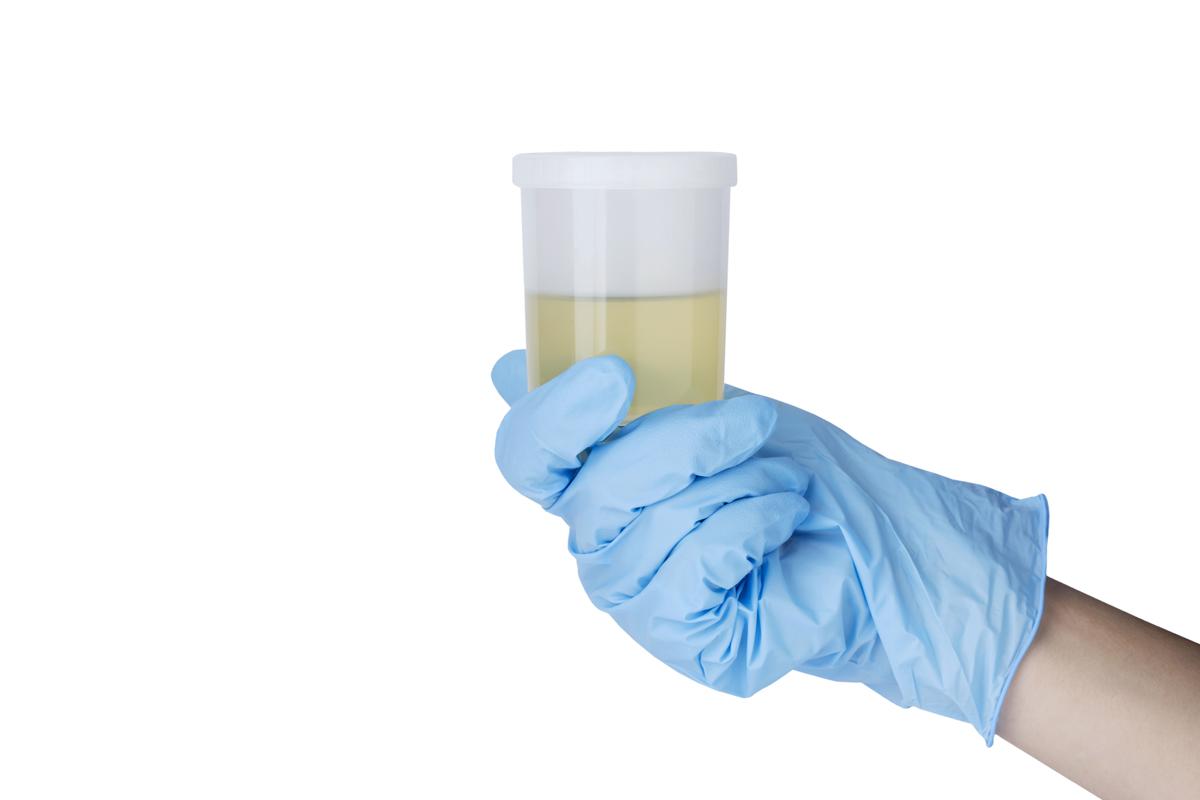 Urine Therapy For Acne