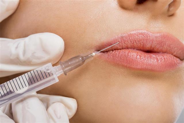Close up of having beauty treatment with Botox