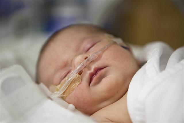 A newborn baby receiving oxygen by nasal Chanukah