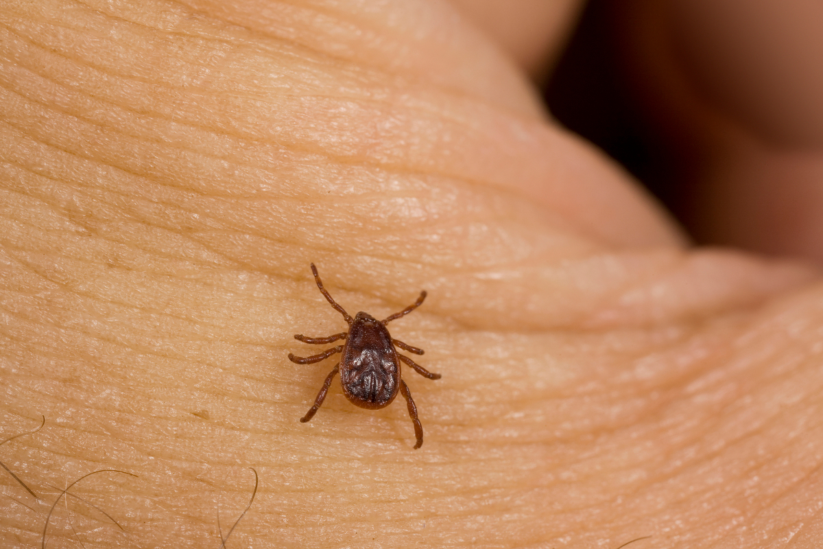 Seed Ticks on Humans