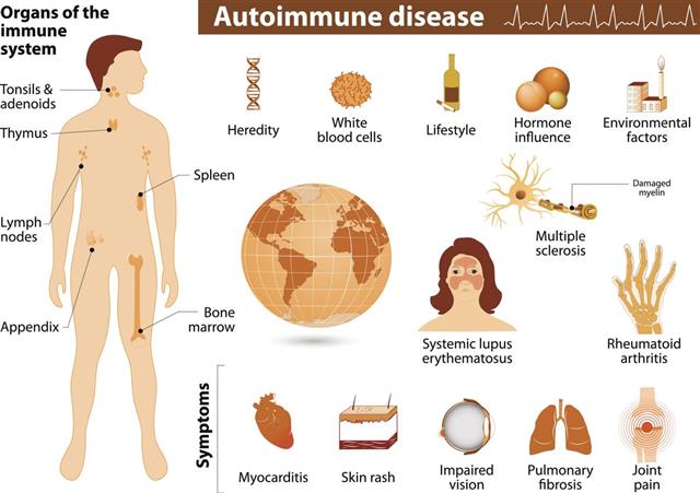 Autoimmune disease infographic