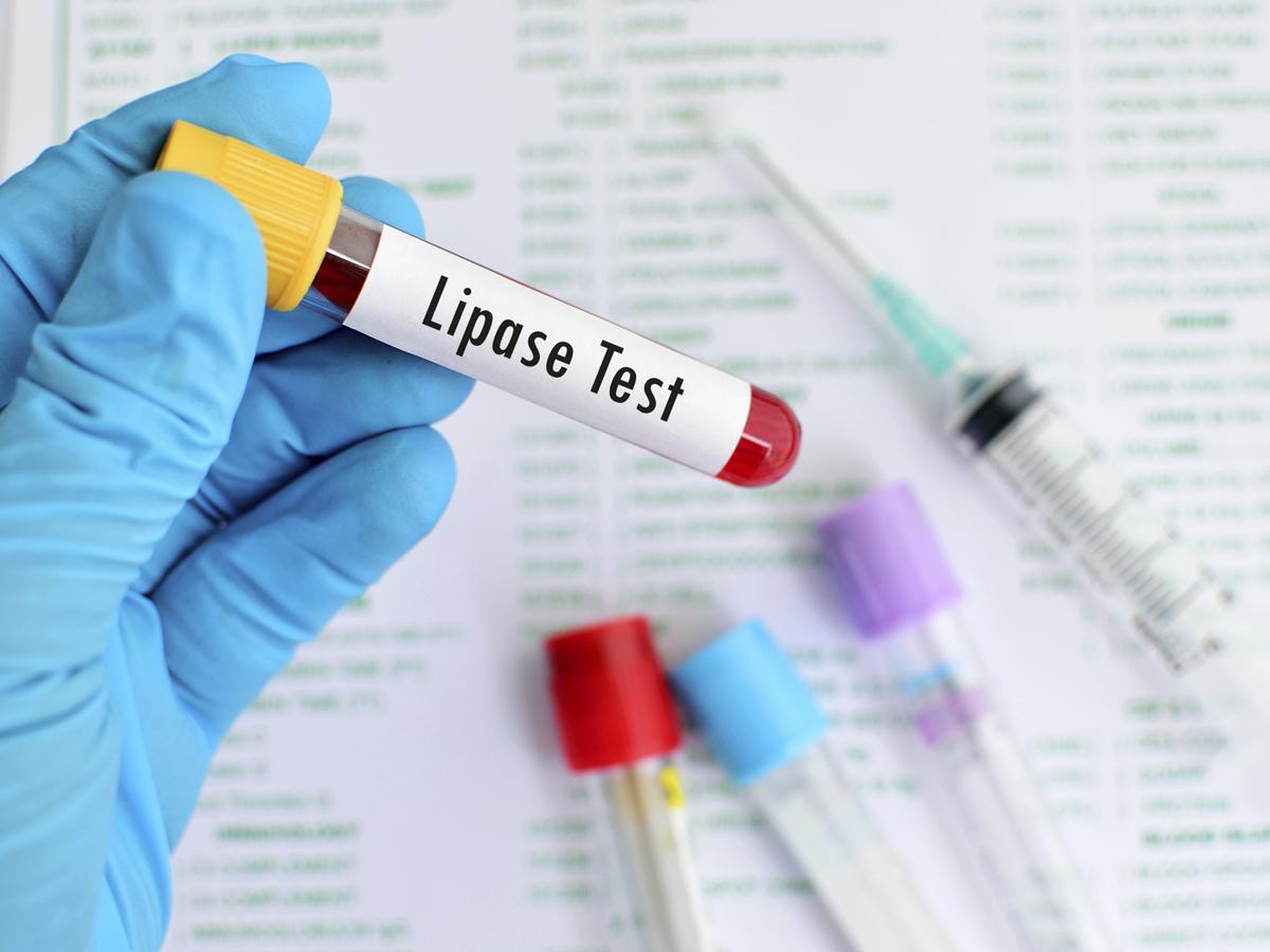 Gastric Lipase Functions