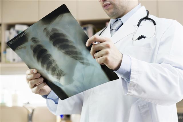 Doctor showing x-ray of lungs. hospital. medical check