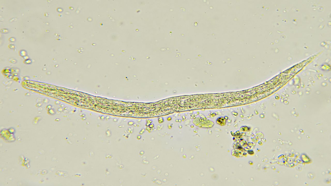 Pinworms in Adults