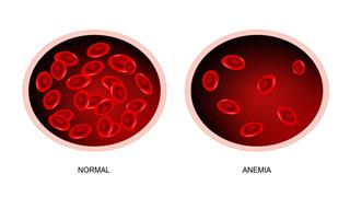 can low b12 give low hematocrit and hemoglobin