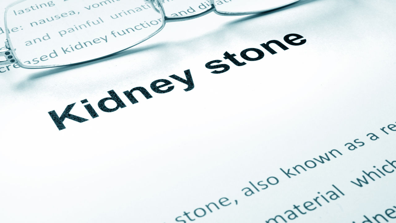 How to Pass a Kidney Stone Quickly