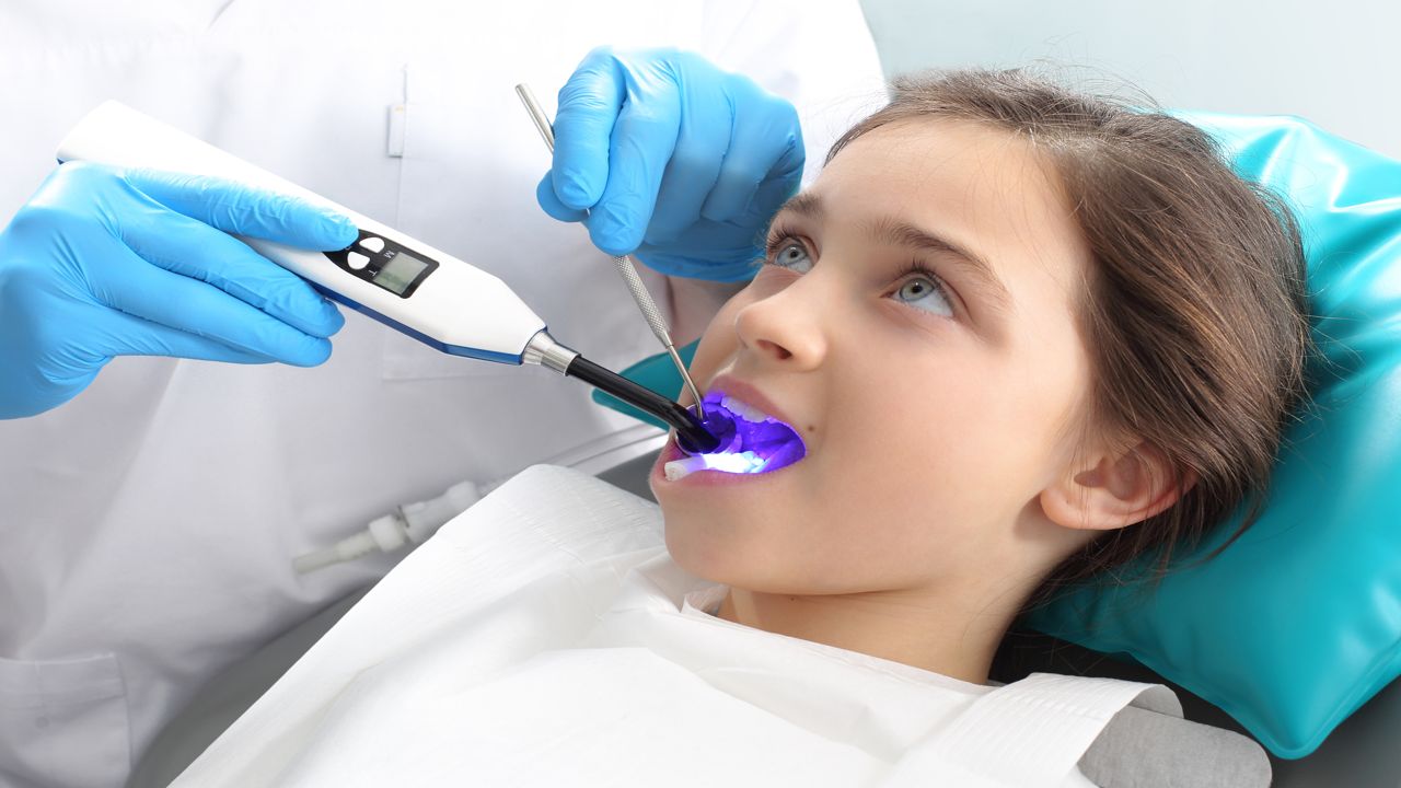 Are Dental Sealants a Safe Choice for Your Child?