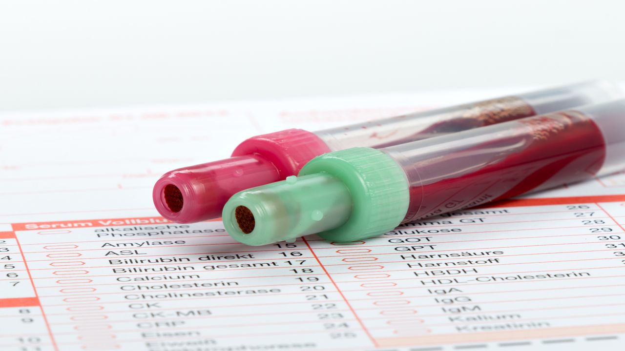 Blood Test Results Explained