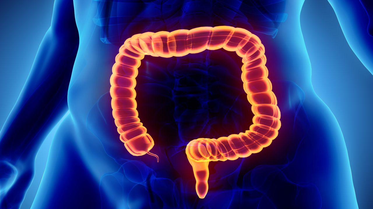 Inflamed Colon